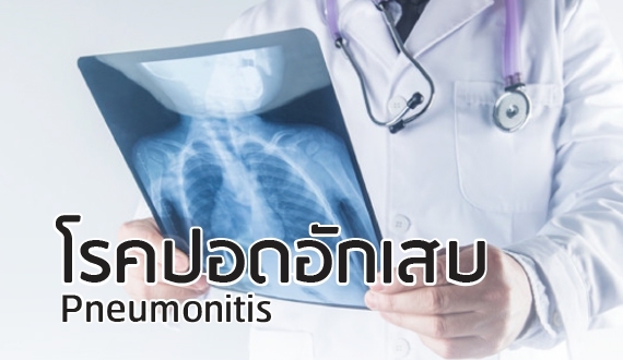 โรคปอดอักเสบ (pneumonitis)